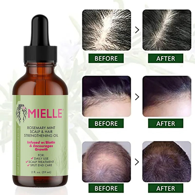 Proven Natural Hair Growth Essential Oil Rosemary Mint - Hair Strengthening Oil Nourishing Treatment